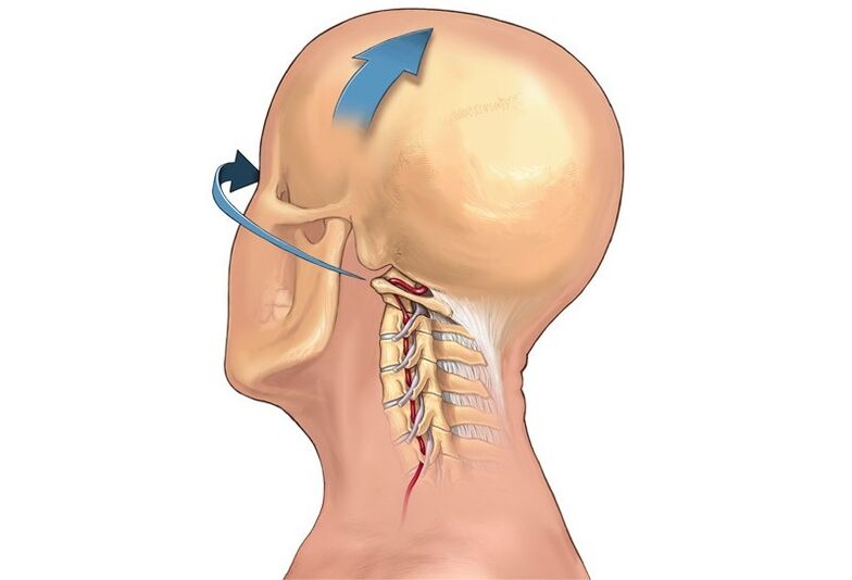 крцкање на вратот при вртење на главата како симптом на цервикална остеохондроза